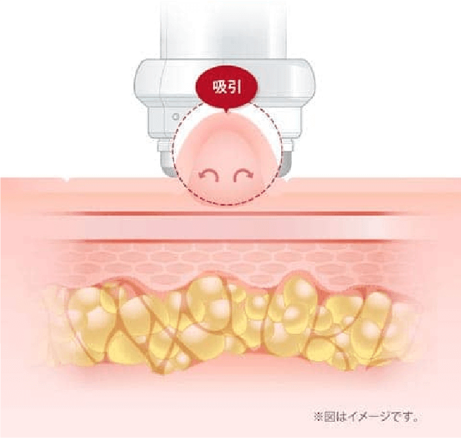 LDダイオード