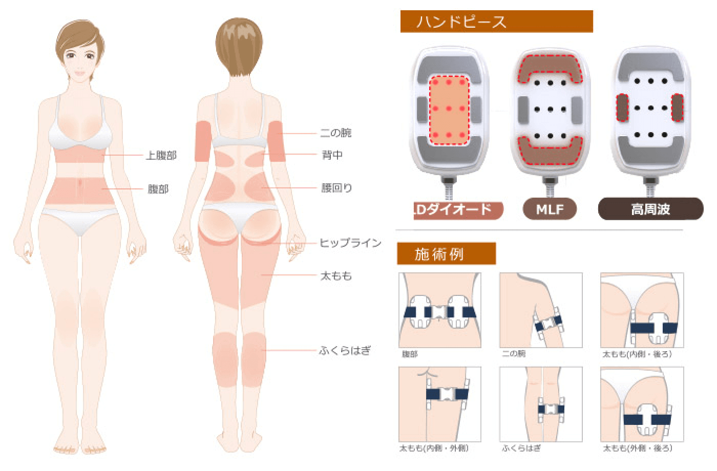 パーフェクトシェイプテクノロジーによる痩身理論